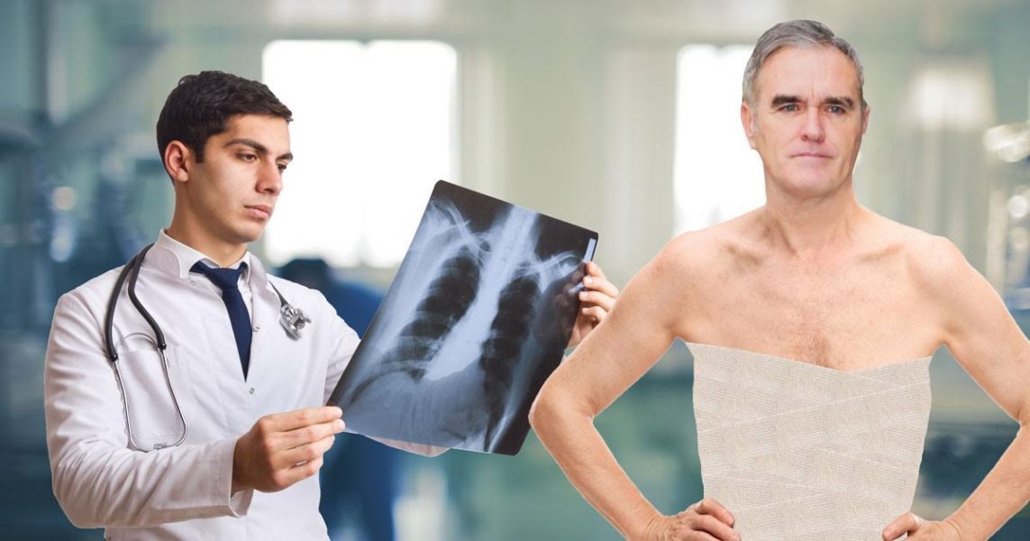 Morrissey Adds Extra Ribs To Prevent Self From Sucking Own Dick 4899