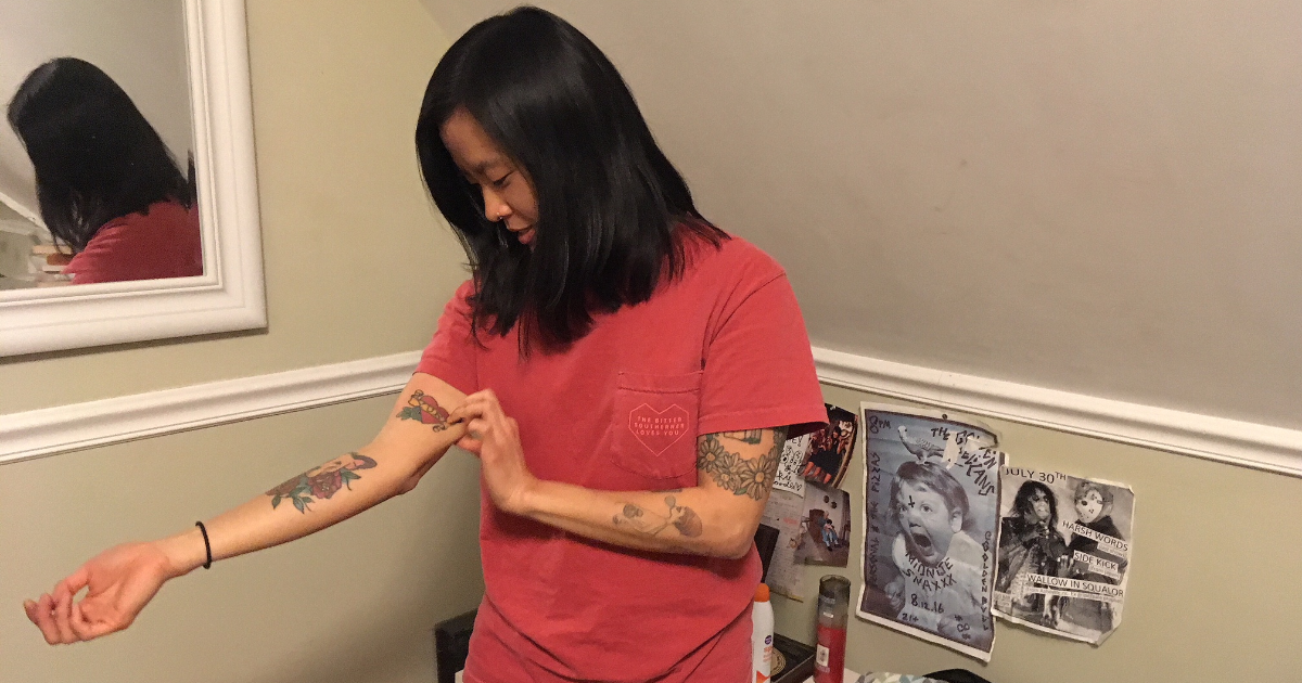 tattoo, removal, woman, unsure