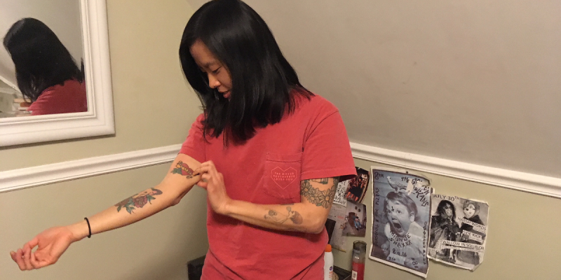 tattoo, removal, woman, unsure