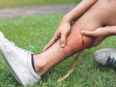 dreadlock, crust, punk, sprout