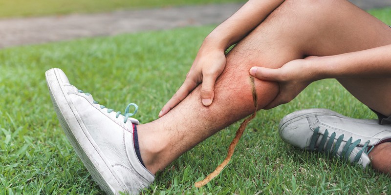 dreadlock, crust, punk, sprout