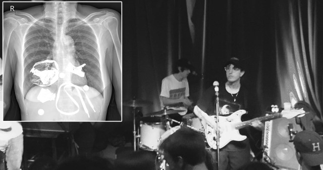 Beach Fossils Drummer Found With Four Pounds of Plastic Garbage in Stomach