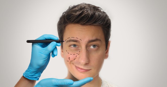 YouTube Critic Undergoes Plastic Surgery for Permanent Skeptical Face