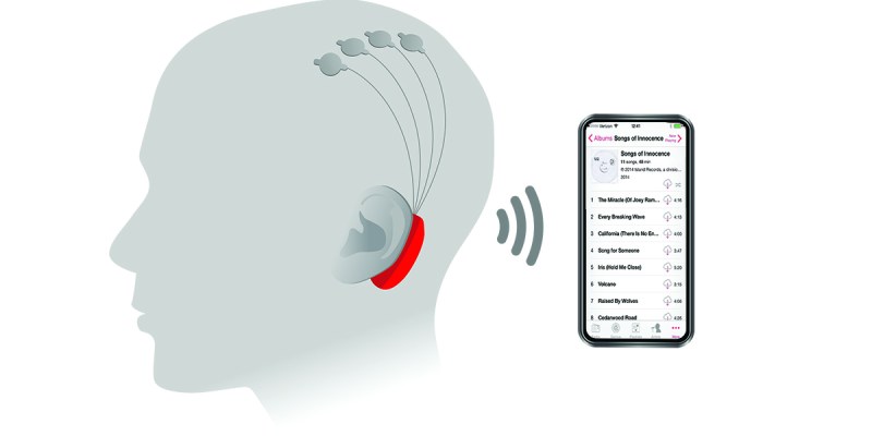 brain, brain implant, AI, technology, U2, album, iTunes, old, annoying