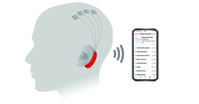 Neuralink Brain Chip Comes Preloaded with Memories of New U2 Record