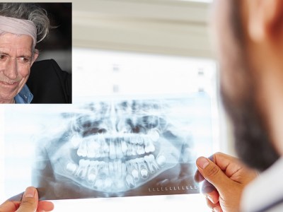 keith richards, dental records, alive