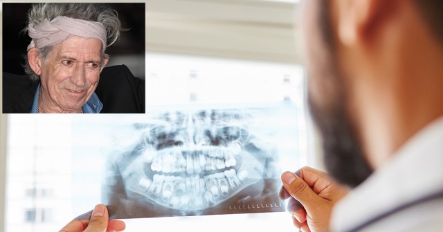 Doctors Use Dental Records to Identify Body of Alive and Well Keith Richards