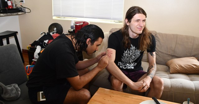 Half-Finished Stick and Poke Already Infected