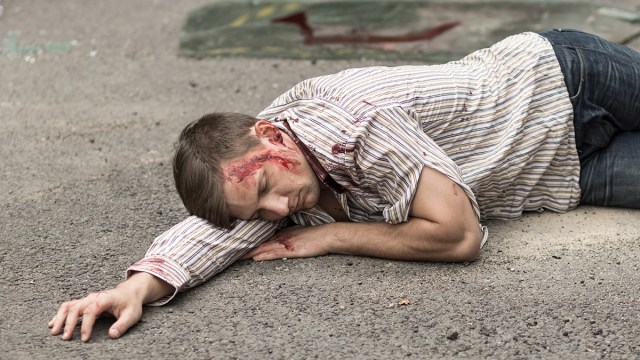 Bassist Who Made Statement on Behalf of Band Beaten Within Inch of Life