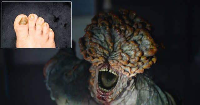 “The Last of Us” VFX Artist Cites Uncle’s Fucked Up Toe as Inspiration