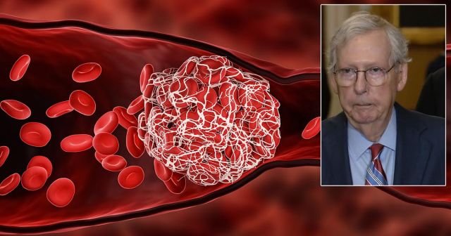 We Sat Down With the Blood Clot in Mitch McConnell’s Brain and Asked When It’s Finally Gonna Make Some Moves
