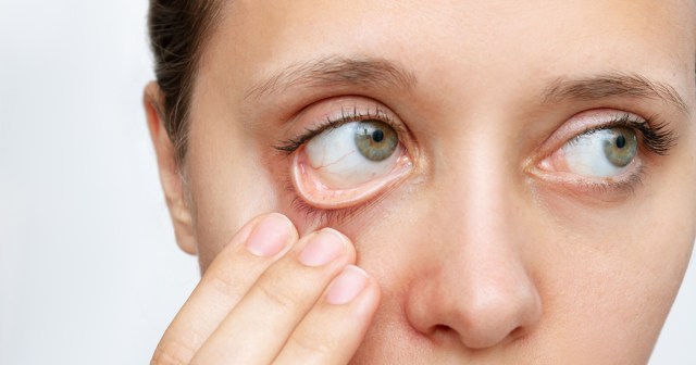 6 Effective Ways To Remain Anemic When It’s Your Only Personality Trait