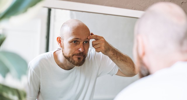 Bald Man Having Bad Skull Day