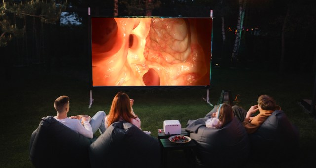 The New David Lynch? I Added Ominous Synth to My Colonoscopy Footage