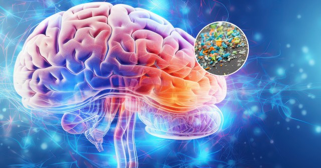What the Microplastics in Your Brain Say About You