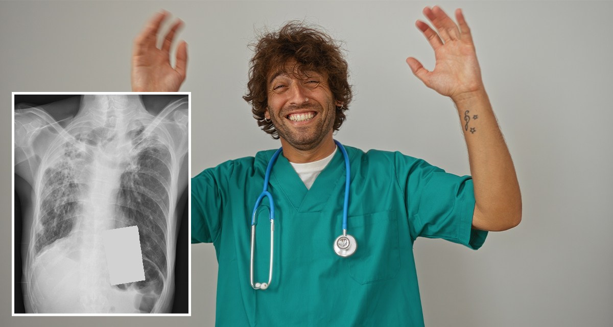 Punk Surgeon Leaves Pack of Smokes Inside Patient