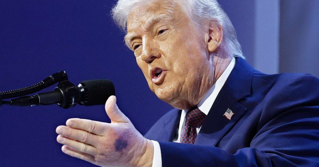 Your Hand Would Look Beat up Too if You Peeled a Whole Orange All by Yourself – Guest Post by Donald Trump