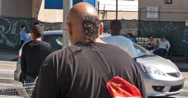 Looksmaxxing Metalhead Purposely Fractures His Cranial Bones To Reshape Skullet