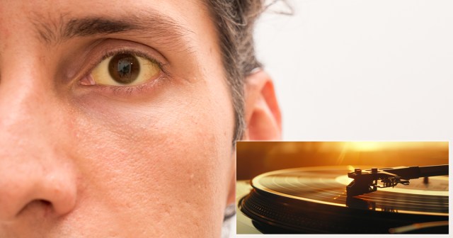 Audiophile Gets Hepatitis C From Dirty Vinyl Needle